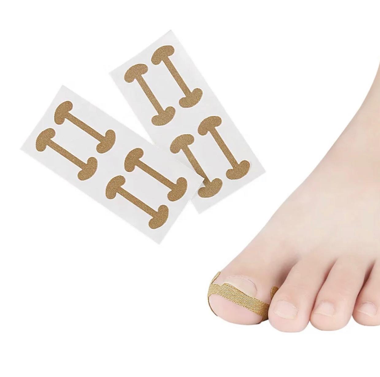 Ingrown Toenail Corrector Stickers Paronychia Treatment Recover Corrector Pedicure Tools Fingernail Toe Nail Care TNB01